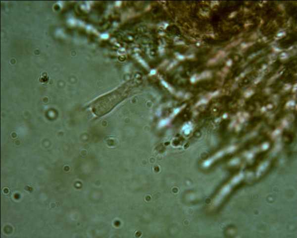 Phlebia tremellosa?